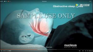 正常呼吸氣道(dào)開(kāi)放(fàng)