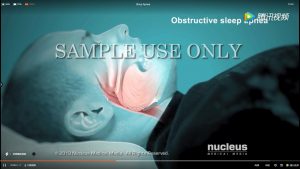 關于睡(shuì)眠呼吸暫停的(de)六個(gè)事(shì)實