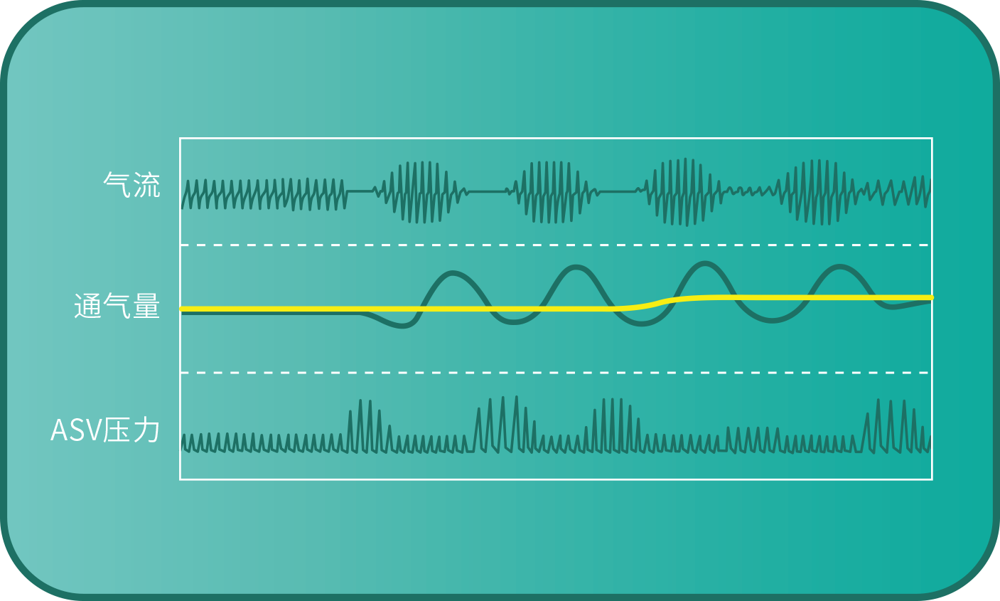 和(hé)普樂(yuè)8系睡(shuì)眠呼吸機(jī)CA820W/CA820 / CA820M