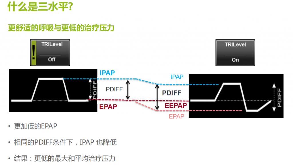三水(shuǐ)平全自(zì)動呼吸機(jī)是(shì)如(rú)何自(zì)動調節壓力的(de)